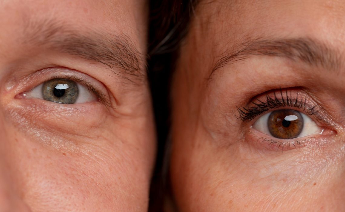 párpados